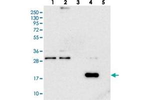 Western blot analysis of Lane 1: RT-4, Lane 2: U-251 MG, Lane 3: Human Plasma, Lane 4: Liver, Lane 5: Tonsil with RWDD4A polyclonal antibody . (RWDD4A Antikörper)