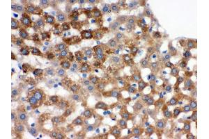 Immunohistochemistry (Paraffin-embedded Sections) (IHC (p)) image for anti-Transferrin (TF) (AA 20-49), (N-Term) antibody (ABIN3043419) (Transferrin Antikörper  (N-Term))