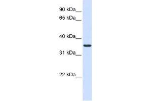 TXNDC14 antibody used at 1 ug/ml to detect target protein. (TMX2 Antikörper  (Middle Region))