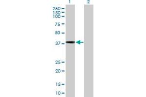Western Blot analysis of KCTD17 expression in transfected 293T cell line by KCTD17 MaxPab polyclonal antibody. (KCTD17 Antikörper  (AA 1-290))