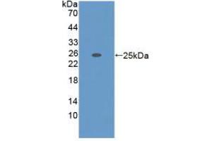 Western blot analysis of recombinant Mouse ADAMTS7. (ADAMTS7 Antikörper  (AA 226-437))