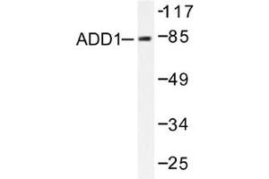 Image no. 2 for anti-Adducin 1 (Alpha) (ADD1) antibody (ABIN265301) (alpha Adducin Antikörper)