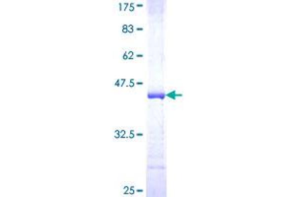 TRAF6 Protein (AA 413-522) (GST tag)