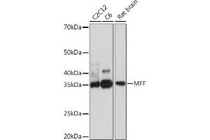 Western blot analysis of extracts of various cell lines, using MFF Rabbit mAb (ABIN7268550) at 1:500 dilution. (MFF Antikörper)