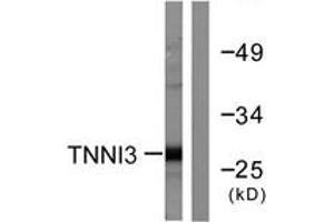 Western blot analysis of extracts from mouse heart cells, using TNNI3 (Ab-22/23) Antibody.
