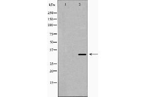 Western blot analysis of HO-1 expression in fetal liver lysate.