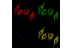 ABIN6259482 and ABIN6275755 staining Hela cells by IF/ICC. (STARD10 Antikörper  (Internal Region))