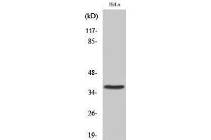 Western Blotting (WB) image for anti-Cysteinyl Leukotriene Receptor 2 (CYSLTR2) (C-Term) antibody (ABIN3184211) (CasLTR2 Antikörper  (C-Term))