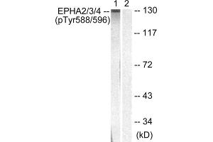 Western blot analysis of extracts from HepG2 cells, using EPHA2/3/4 (Phospho-Tyr588/596) antibody. (EPHA2/3 Antikörper  (pTyr588, pTyr596))