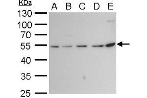 WB Image beta Tubulin 2 antibody detects beta Tubulin 2 protein by western blot analysis. (TUBB2A Antikörper)