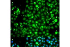 Immunofluorescence analysis of A549 cells using NME2 Polyclonal Antibody (NME2 Antikörper)