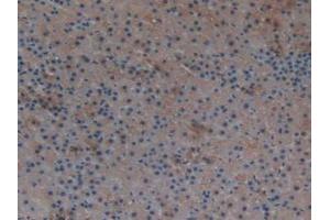 IHC-P analysis of Rat Adrenal Gland Tissue, with DAB staining. (TXNRD1 Antikörper  (AA 208-433))