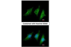 ICC/IF Image Immunofluorescence analysis of methanol-fixed HeLa, using CD55, antibody at 1:200 dilution. (CD55 Antikörper  (Center))