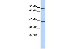 Western Blotting (WB) image for anti-DEAH (Asp-Glu-Ala-His) Box Polypeptide 35 (DHX35) antibody (ABIN2458247) (DHX35 Antikörper)