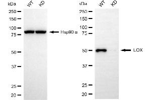 Western blotting analysis using LOX antibody (ABIN7799311). (Rekombinanter LOX Antikörper)