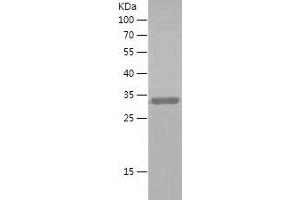 Western Blotting (WB) image for Friend Leukemia Virus Integration 1 (FLI1) (AA 185-452) protein (His tag) (ABIN7123005) (FLI1 Protein (AA 185-452) (His tag))