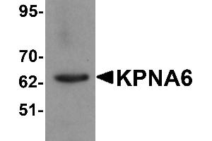 Western blot analysis of KPNA6 in 293 cell lysate with KPNA6 antibody at 1 µg/mL. (KPNA6 Antikörper  (N-Term))