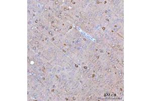 IHC analysis of BCAT1 using anti-BCAT1 antibody (ABIN7602594).