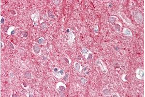 ABIN571009 (3. (CD90 Antikörper  (Internal Region))