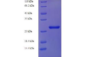 SDS-PAGE (SDS) image for NQO2 (NQO2) (AA 1-231), (full length) protein (His tag) (ABIN5714374)