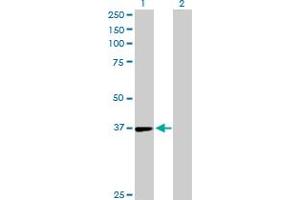 Western Blot analysis of TSTA3 expression in transfected 293T cell line by TSTA3 MaxPab polyclonal antibody. (TSTA3 Antikörper  (AA 1-321))