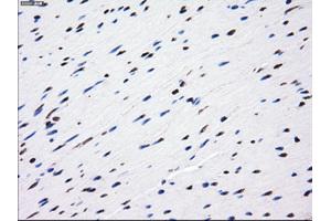 Immunohistochemical staining of paraffin-embedded liver tissue using anti-LOXmouse monoclonal antibody. (LOX Antikörper  (AA 22-168))