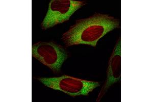 Fluorescent image of Hela cell stained with EIF4E Antibody (ABIN659032 and ABIN2838050)/SG101020AF.