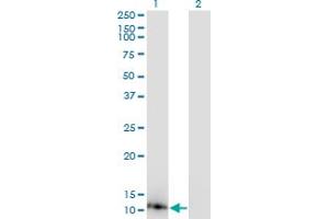 Western Blot analysis of DYNLL1 expression in transfected 293T cell line by DYNLL1 monoclonal antibody (M02), clone 1H7. (DYNLL1 Antikörper  (AA 1-72))