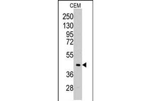 Western blot analysis of ALDOC polyclonal antibody  in CEM cell line lysates (35 ug/lane). (ALDOC Antikörper  (C-Term))