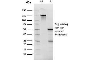 SDS-PAGE Analysis Purified Topo I, MT Mouse Monoclonal Antibody (TOP1MT/568). (TOP1MT Antikörper)
