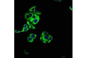 Immunofluorescence staining of PC-3 cells with ABIN7143505 at 1:100, counter-stained with DAPI. (ARL4C Antikörper  (AA 2-192))