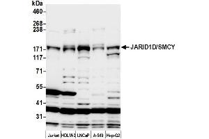 anti-Lysine (K)-Specific Demethylase 5D (KDM5D) (AA 1490-1540) antibody
