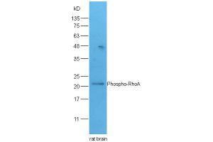 Lane 1: rat brain lysates probed with Rabbit Anti-RhoA(Ser188) Polyclonal Antibody, Unconjugated (ABIN758242) at 1:300 overnight at 4 °C. (RHOA Antikörper  (pSer188))