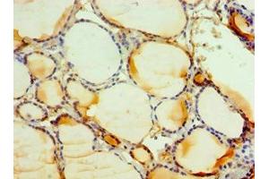 Immunohistochemistry of paraffin-embedded human thyroid tissue using ABIN7146163 at dilution of 1:100 (C3AR1 Antikörper  (AA 160-340))