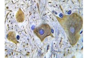 Immunohistochemistry (IHC) analyzes of p-NMDAR1 antibody in paraffin-embedded human spinal cord tissue. (NMDA 1 Receptor Antikörper  (pSer896))