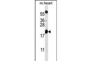 BCL2 Antibody (Center) (ABIN657744 and ABIN2846728) western blot analysis in mouse heart tissue lysates (35 μg/lane).