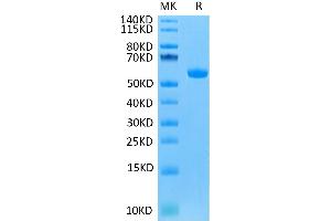 Human FGF21 on Tris-Bis PAGE under reduced condition. (FGF21 Protein (mFc-Avi Tag))