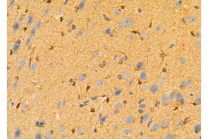ABIN6264674 and ABIN6277694 at 1/100 staining Rat brain tissue by IHC-P.