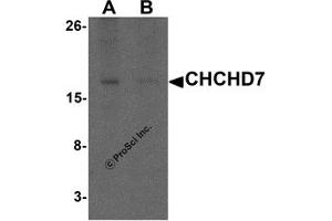 Western Blotting (WB) image for anti-Coiled-Coil-Helix-Coiled-Coil-Helix Domain Containing 7 (CHCHD7) (C-Term) antibody (ABIN1077411) (CHCHD7 Antikörper  (C-Term))