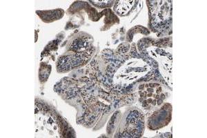 Immunohistochemical staining of human placenta with GLG1 polyclonal antibody  shows strong dot like cytoplasmic positivity in trophoblastic and decidual cells at 1:50-1:200 dilution.