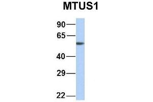 Western Blotting (WB) image for anti-Microtubule Associated Tumor Suppressor 1 (MTUS1) (Middle Region) antibody (ABIN2781855)