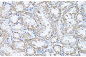 Immunohistochemistry of paraffin-embedded Rat kidney using Snail Polyclonal Antibody at dilution of 1:100 (40x lens). (SNAIL Antikörper)