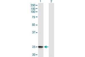 Western Blot analysis of IFNK expression in transfected 293T cell line by IFNK MaxPab polyclonal antibody. (IFNK Antikörper  (AA 1-207))