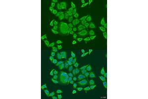 Immunofluorescence analysis of U2OS cells using DHX58 antibody (ABIN6129372, ABIN6139609, ABIN6139610 and ABIN6224272) at dilution of 1:100. (DHX58 Antikörper  (AA 389-678))
