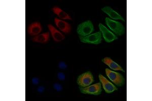 ABIN6266210 and ABIN6277363 staining Hela cells by IF/ICC. (ENPP7 Antikörper  (Internal Region))