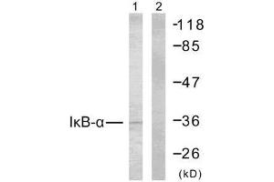 Western blot analysis of extracts from MCF7 cells using IκB-α (Ab-32/36) antibody (E021122). (NFKBIA Antikörper)