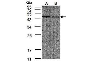 WB Image Sample(30 μg of whole cell lysate) A:293T B:A431, 12% SDS PAGE antibody diluted at 1:200 (EIF4A2 Antikörper  (N-Term))