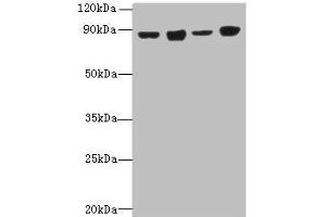 Western blot All lanes: DDX50 antibody at 4 μg/mL Lane 1: Hela whole cell lysate Lane 2: Jurkat whole cell lysate Lane 3: K562 whole cell lysate Lane 4: 293T whole cell lysate Secondary Goat polyclonal to rabbit IgG at 1/10000 dilution Predicted band size: 83 kDa Observed band size: 83 kDa (DDX5 Antikörper  (AA 1-210))