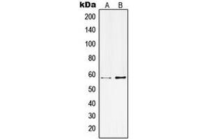 Western blot analysis of Kv3. (KCNC1 Antikörper  (Center))
