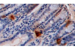 Detection of 5-HT in Mouse Small intestine Tissue using Polyclonal Antibody to 5-Hydroxytryptamine (5-HT)